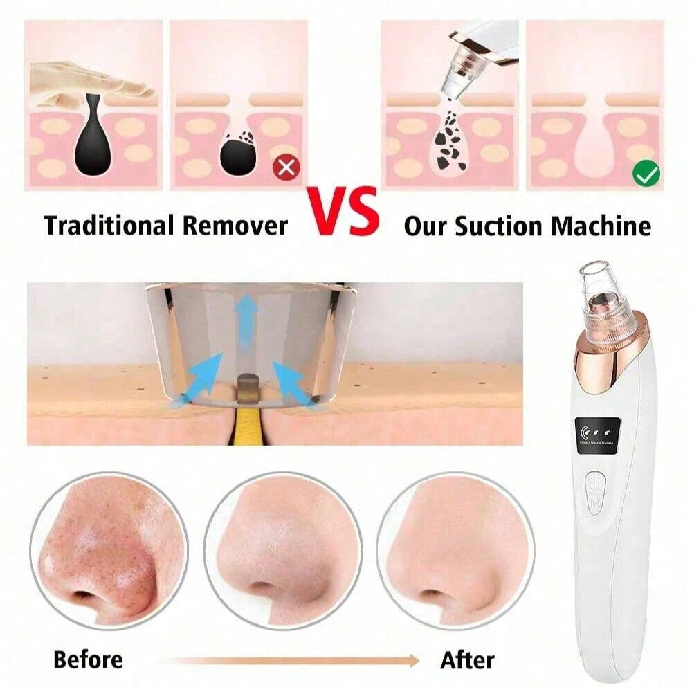 Arabic Mall – Electric Acne Pore Cleaner & Blackhead Remover