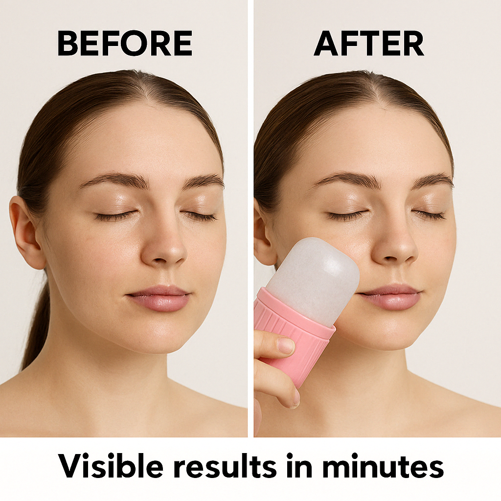 Arabic Mall™-Ice Face Roller